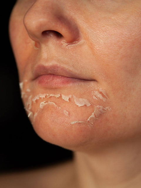 Avoid Overwashing Your Face