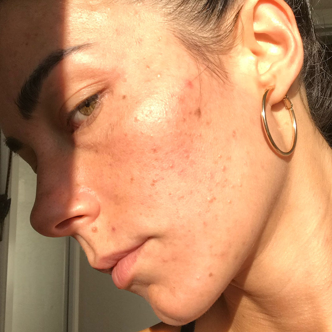 Why 'Clean' Skincare Keeps Flaring Sensitive Skin in Perimenopause (and the One-Step Ritual People Are Switching To)