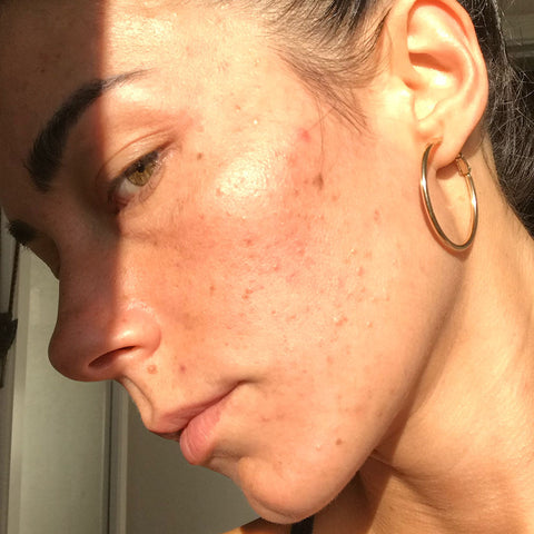 Why 'Clean' Skincare Keeps Flaring Sensitive Skin in Perimenopause (and the One-Step Ritual People Are Switching To)